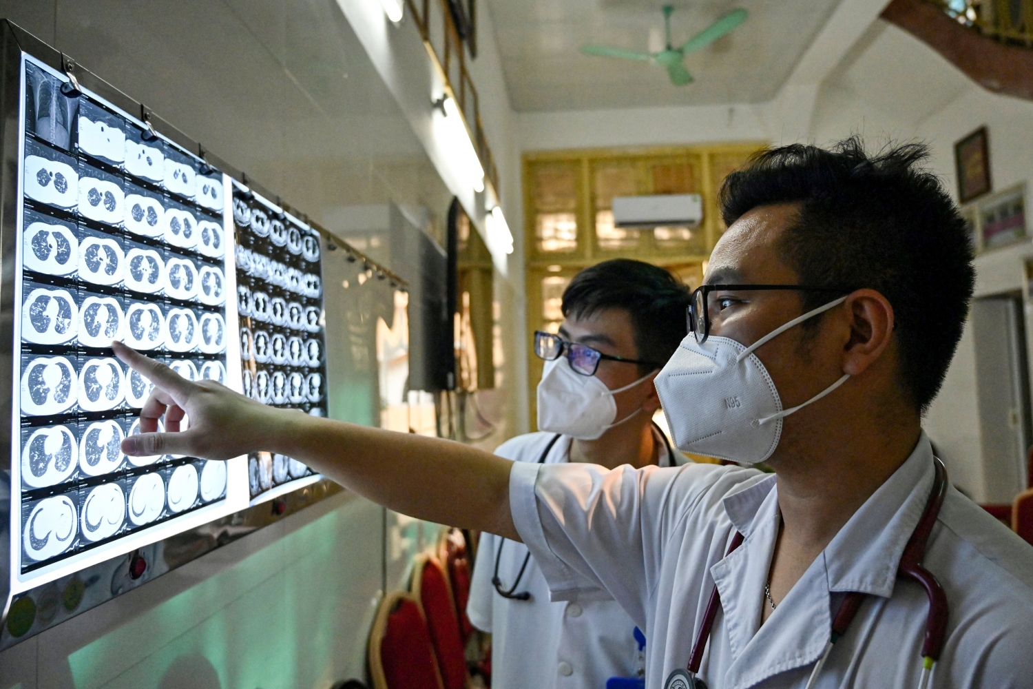 TB is the No. 1 killer among infectious diseases. A new study says its toll could mount